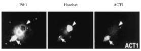 APP-C31 | Caspase 3 cleaved APP, C terminal fragment in the group Antibodies Human Cell Biology / Neuroscience / Neurodegenerative diseases / Alzheimer's disease at Agrisera AB (Antibodies for research) (AS21 4570)